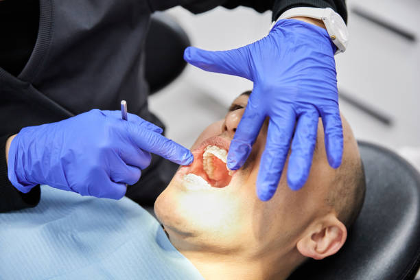 Best Emergency Dental Care for Sports Injuries in Norway, MI